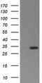 Retinoic Acid Receptor Responder 1 antibody, LS-C788027, Lifespan Biosciences, Western Blot image 