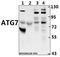 Autophagy Related 7 antibody, A00346-3, Boster Biological Technology, Western Blot image 