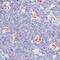 Epstein Barr Virus antibody, MA5-12172, Invitrogen Antibodies, Immunohistochemistry paraffin image 