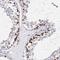 E3 ubiquitin-protein ligase RFWD3 antibody, FNab07257, FineTest, Immunohistochemistry frozen image 