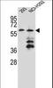 PRAME Family Member 12 antibody, LS-C162110, Lifespan Biosciences, Western Blot image 
