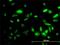 Pep4 antibody, H00005184-M01, Novus Biologicals, Immunocytochemistry image 