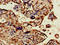 Obscurin Like 1 antibody, LS-C678898, Lifespan Biosciences, Immunohistochemistry paraffin image 