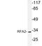 RPA32 antibody, LS-C176556, Lifespan Biosciences, Western Blot image 