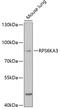 Ribosomal Protein S6 Kinase A3 antibody, 19-659, ProSci, Western Blot image 
