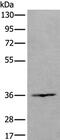 Homeobox protein Hox-D10 antibody, PA5-67572, Invitrogen Antibodies, Western Blot image 