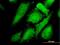 Mitogen-activated protein kinase 12 antibody, H00006300-M06, Novus Biologicals, Immunocytochemistry image 