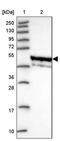 Serine Palmitoyltransferase Long Chain Base Subunit 3 antibody, PA5-60657, Invitrogen Antibodies, Western Blot image 