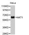 Akt antibody, abx127099, Abbexa, Western Blot image 