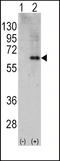 Protein Kinase AMP-Activated Catalytic Subunit Alpha 2 antibody, LS-C100607, Lifespan Biosciences, Western Blot image 