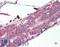 BAP antibody, LS-B2316, Lifespan Biosciences, Immunohistochemistry paraffin image 