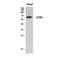 Leukocyte Immunoglobulin Like Receptor B5 antibody, A10961, Boster Biological Technology, Western Blot image 