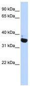 Olfactory Receptor Family 13 Subfamily C Member 5 antibody, TA330183, Origene, Western Blot image 