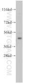 Dyslexia susceptibility 1 candidate gene 1 protein antibody, 14522-1-AP, Proteintech Group, Western Blot image 