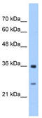 Glutathione S-Transferase Zeta 1 antibody, TA330970, Origene, Western Blot image 