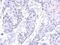 Zinc Finger Protein 571 antibody, NBP2-15176, Novus Biologicals, Immunohistochemistry frozen image 