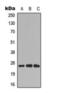 Cell Division Cycle Associated 4 antibody, orb393238, Biorbyt, Western Blot image 