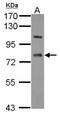 Lanosterol Synthase antibody, NBP2-17184, Novus Biologicals, Western Blot image 