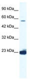 DEAD-Box Helicase 55 antibody, TA341613, Origene, Western Blot image 