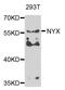Nyctalopin antibody, orb373794, Biorbyt, Western Blot image 