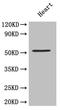 ST2 antibody, CSB-PA07019A0Rb, Cusabio, Western Blot image 