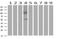 AP2M1 antibody, MA5-25570, Invitrogen Antibodies, Western Blot image 