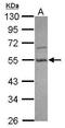 Par-6 Family Cell Polarity Regulator Beta antibody, GTX116985, GeneTex, Western Blot image 