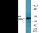 Casein Kinase 2 Alpha 1 antibody, EKC2331, Boster Biological Technology, Western Blot image 