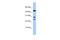 Chromosome 20 Open Reading Frame 141 antibody, A15270, Boster Biological Technology, Western Blot image 