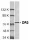 TNF Receptor Superfamily Member 25 antibody, SP1167P, Origene, Western Blot image 
