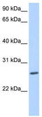 Zinc Finger Protein 664 antibody, TA339915, Origene, Western Blot image 