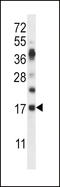 Ribonuclease A Family Member K6 antibody, LS-C162638, Lifespan Biosciences, Western Blot image 