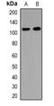 Ubiquitin carboxyl-terminal hydrolase 37 antibody, orb382488, Biorbyt, Western Blot image 