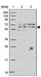 UTP18 Small Subunit Processome Component antibody, PA5-62596, Invitrogen Antibodies, Western Blot image 