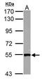 SET And MYND Domain Containing 1 antibody, PA5-34892, Invitrogen Antibodies, Western Blot image 