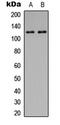 Protein Tyrosine Kinase 2 antibody, LS-C358276, Lifespan Biosciences, Western Blot image 