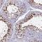 Inhibitory Synaptic Factor 2A antibody, HPA035898, Atlas Antibodies, Immunohistochemistry frozen image 