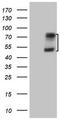 Activin receptor type IIA antibody, TA807410S, Origene, Western Blot image 