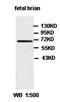 Zinc Finger DHHC-Type Containing 5 antibody, orb77686, Biorbyt, Western Blot image 