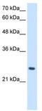 Phosphopantothenoylcysteine Decarboxylase antibody, TA339355, Origene, Western Blot image 