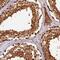 Sterile Alpha Motif Domain Containing 4A antibody, PA5-60224, Invitrogen Antibodies, Immunohistochemistry frozen image 