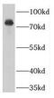 Guanylate cyclase soluble subunit alpha-3 antibody, FNab03726, FineTest, Western Blot image 