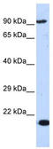 Minichromosome Maintenance Complex Component 7 antibody, TA341695, Origene, Western Blot image 