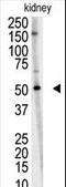 Ring Finger Protein 216 antibody, LS-C98008, Lifespan Biosciences, Western Blot image 