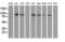 Serine/threonine-protein kinase D2 antibody, GTX83817, GeneTex, Western Blot image 