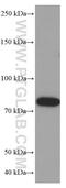 Zinc Finger And BTB Domain Containing 16 antibody, 66672-1-Ig, Proteintech Group, Western Blot image 