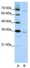 Wnt Family Member 5B antibody, TA344082, Origene, Western Blot image 