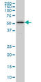 ZPR1 Zinc Finger antibody, LS-C133096, Lifespan Biosciences, Western Blot image 