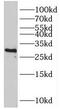Tropomyosin 4 antibody, FNab08892, FineTest, Western Blot image 