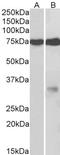 Glycoprotein M6A antibody, STJ72438, St John